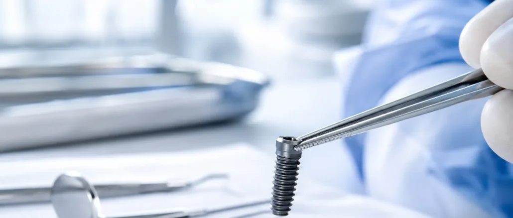 Implantat setzen: Wie lange krank? Erholungszeit und Krankschreibung im Überblick